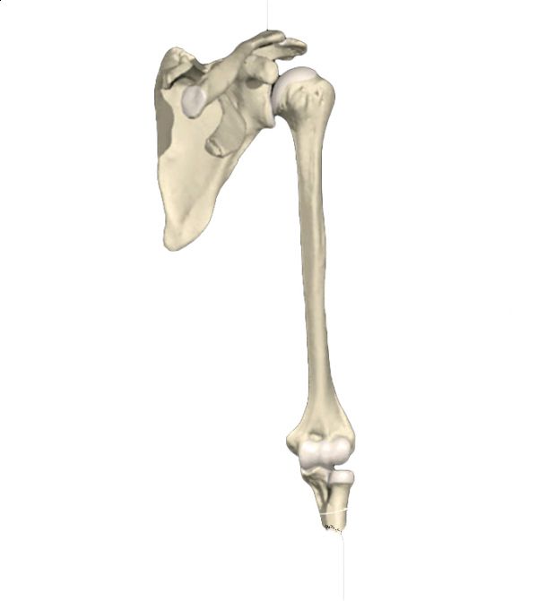 Fractura de humerus