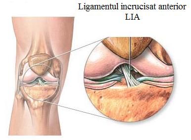 Ligament incrucisat anterior LIA