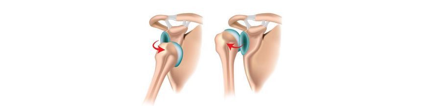 luxația unguentelor articulațiilor umărului durere în regiunea lombară și articulația șoldului