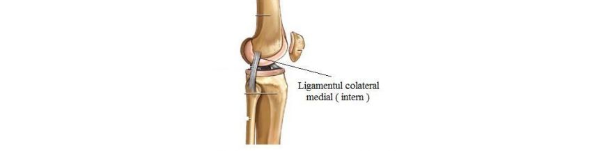 refacerea ligamentului colateral medial al șocului)